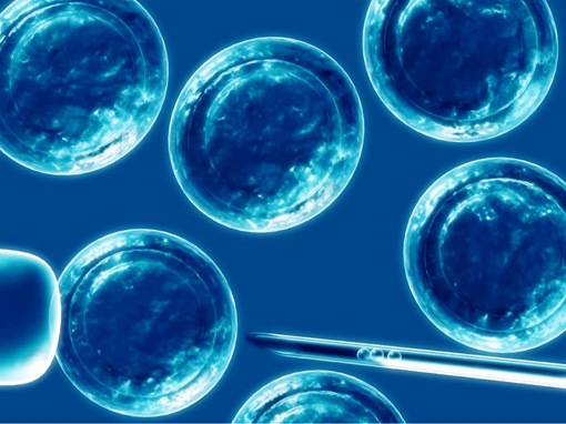 Esclerosis múltiple mejoraría al usar células madres