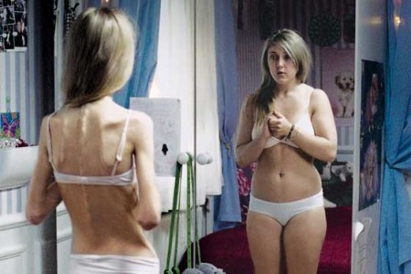 Anorexia-bulimia e internet Anorexia-bulimia e internet
