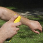 Trucos contra las picaduras de mosquito