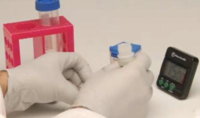 Visto bueno a test r谩pido para detectar tuberculosis Visto bueno a test r谩pido para detectar tuberculosis