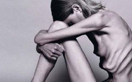 Bulimia y Anorexia: Un mal que nos afecta a todos Bulimia y Anorexia: Un mal que nos afecta a todos