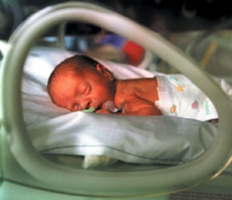 premature-infant1