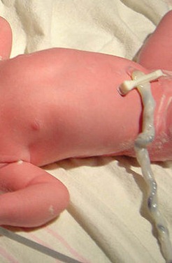 cordon-umbilical-bebe