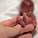 bebe-prematuro-de-19-semanas-que-consiguio-vivir-unos-minutos-conmueve-a-millones-de-personas-Walter-Joshua-Fretz-pies