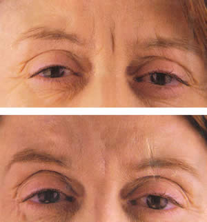 Estos son algunos de los resultados