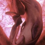 12-increibles-fotos-de-12-animales-en-el-utero-de-la-madre-delfin