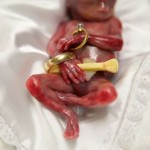 bebe-prematuro-de-19-semanas-que-consiguio-vivir-unos-minutos-conmueve-a-millones-de-personas-Walter-Joshua-Fretz-foto-con-anillos-de-boda