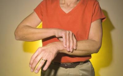 Síntomas de artritis
