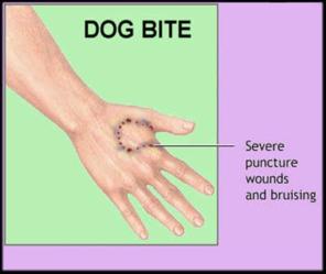 dogbitehand