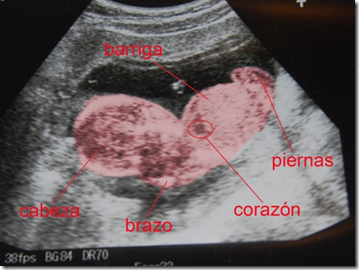 Ultrasonidos en el Embarazo