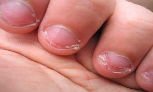 La apariencia de las uñas signo de belleza y salud