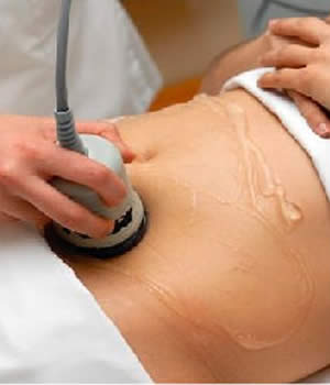 Para verse con un cuerpo espectacular recurra a la Lipocavitación un tratamiento sin cirugía Para verse con un cuerpo espectacular recurra a la Lipocavitación un tratamiento sin cirugía