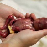 bebe-prematuro-19-semanas-consiguio-vivir-unos-minutos-conmueve-millones-personas