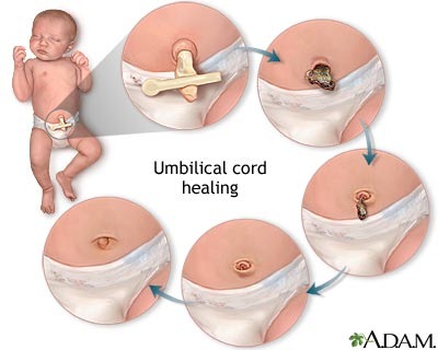 cuidados cordon del bebe recién nacido