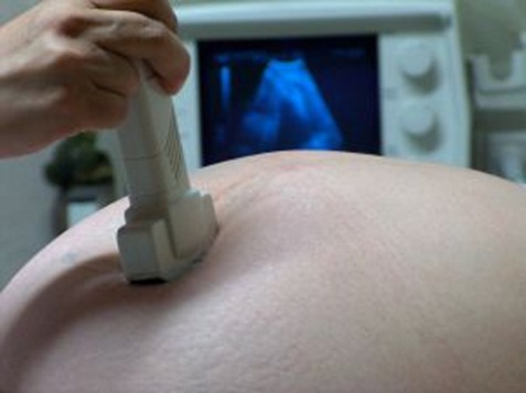 pregnancy-ultrasound