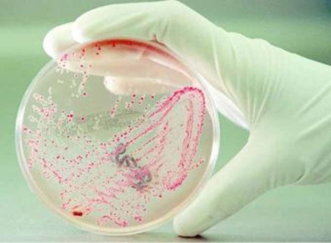 -cultivo-bacteria-i-escherichia-coli-i-laboratorio