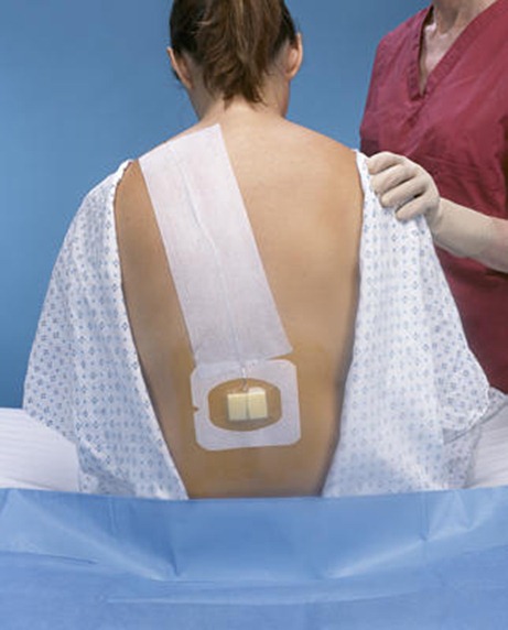 Contraindicaciones de la anestesia epidural