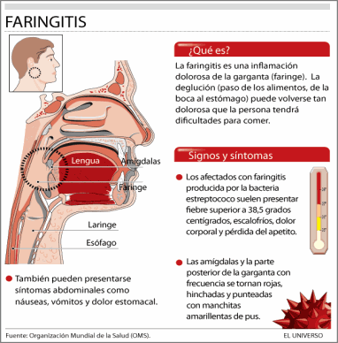 faringitis