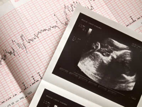fetal_ultrasound