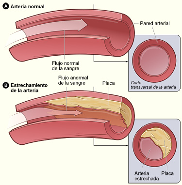 Novedoso estudio para medir la edad real de las arterias