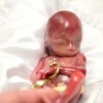 bebe-prematuro-de-19-semanas-que-consiguio-vivir-unos-minutos-conmueve-a-millones-de-personas-Walter-Joshua-Fretz