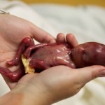 bebe-prematuro-de-19-semanas-que-consiguio-vivir-unos-minutos-conmueve-a-millones-de-personas-Walter-Joshua-Fretz-otra-de-cuerpo-entero