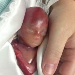 bebe-prematuro-de-19-semanas-que-consiguio-vivir-unos-minutos-conmueve-a-millones-de-personas-Walter-Joshua-Fretz-cabecita