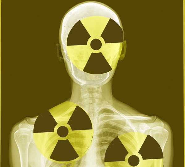 Las radiaciones medicas en perspectiva