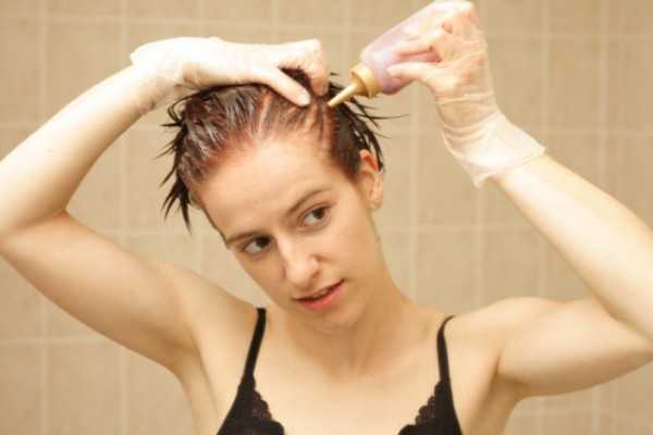 Tratar alergias a tinturas del cabello