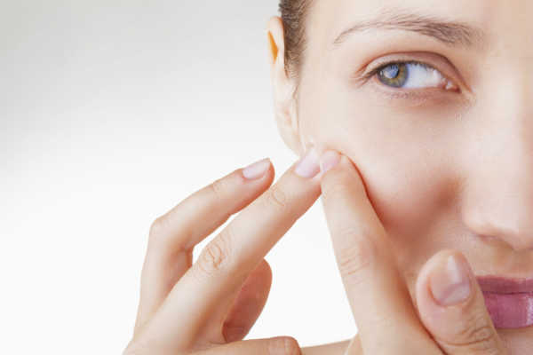 Tratamientos internos para el acné y como se preparan