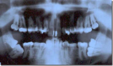 301508860_82434afb92 301508860_82434afb92