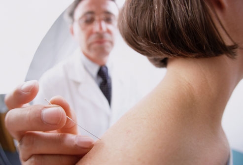 Acupuntura: tratamiento para la pérdida de cabello 1.jpg Acupuntura: tratamiento para la pérdida de cabello 1.jpg