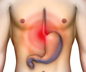 Causas de la acidez estomacal5.jpg Causas de la acidez estomacal5.jpg