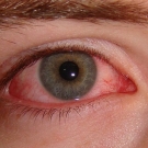 Cómo proteger los ojos_evitar sequedad en los ojos.jpg