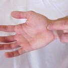 Cómo saber si tengo diabetes entumecimiento.jpg