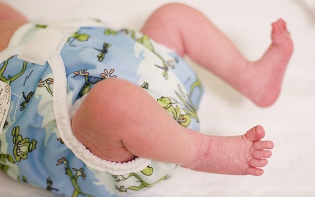 Crema-natural-para-la-dermatitis-de-pañal-2.jpg Crema-natural-para-la-dermatitis-de-pañal-2.jpg