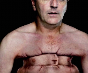 Dolor en el pecho La angina de pecho .jpg Dolor en el pecho La angina de pecho .jpg