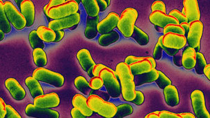 La bacteria fue responsable de unos 50 millones de muertes en Europa en el siglo XIV.
