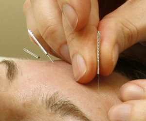 Ventajas y desventajas de la acupuntura 1.jpg Ventajas y desventajas de la acupuntura 1.jpg