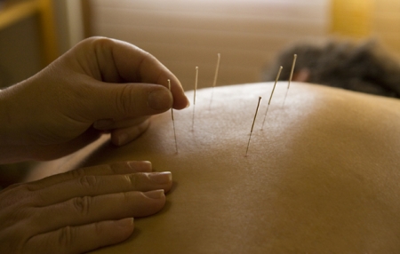 acupuntura-bajarpeso1.jpg