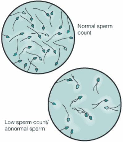 Calidad del esperma y comer grasas
