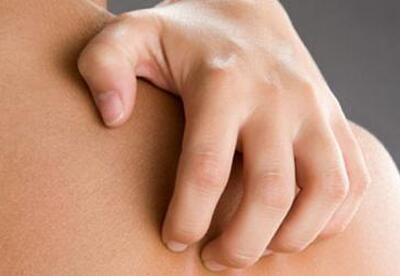 Tratamiento para la dermatitis Tratamiento para la dermatitis