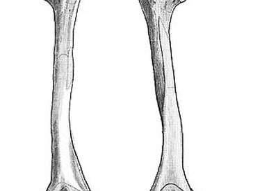 Conbriza: nuevo medicamento para el tratamiento de la osteoporosis Conbriza: nuevo medicamento para el tratamiento de la osteoporosis