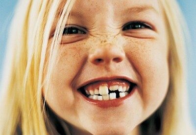 Alimentos para los dientes de los niños Alimentos para los dientes de los niños