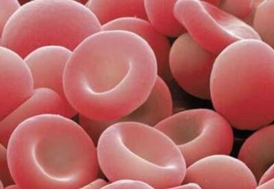 Como aumentar la hemoglobina Como aumentar la hemoglobina