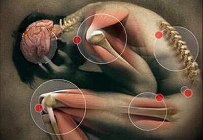 5 consejos para la aliviar la artritis y artrosis 5 consejos para la aliviar la artritis y artrosis