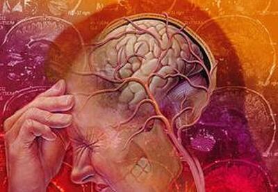 Migrañas tratamiento Migrañas tratamiento