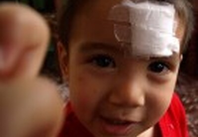 Cómo curar una herida a los niños Cómo curar una herida a los niños