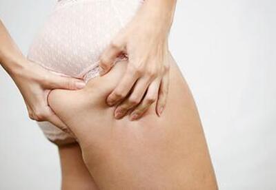 Combatir la celulitis naturalmente Combatir la celulitis naturalmente