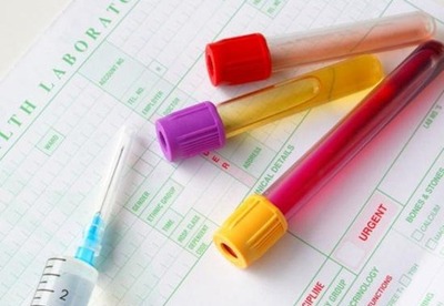 Pruebas fertilidad | Analisis sangre, orina Pruebas fertilidad | Analisis sangre, orina
